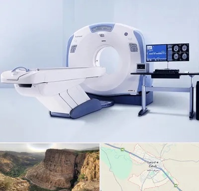 سی تی اسکن شبانه روزی در سرپل ذهاب