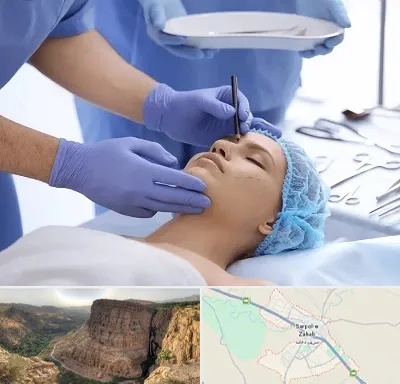 عمل بینی طبیعی در سرپل ذهاب