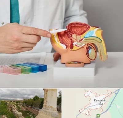 دکتر اورولوژی در کنگاور
