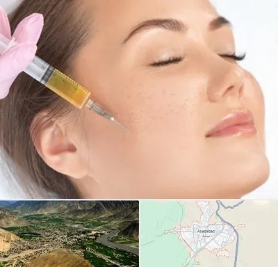 آموزش تزریق ژل و بوتاکس در اسدآباد