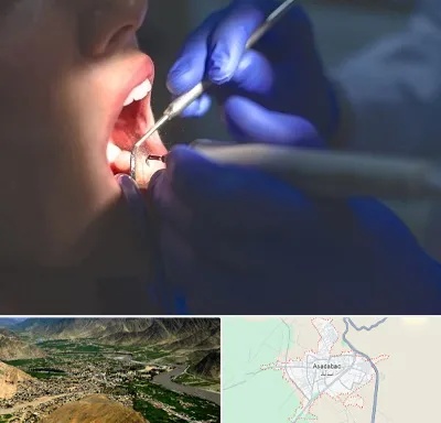 عصب کشی در اسدآباد