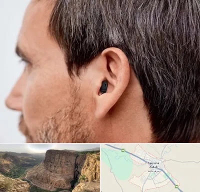 سمعک نامرئی در سرپل ذهاب