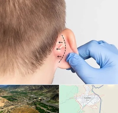 عمل زیبایی گوش در اسدآباد