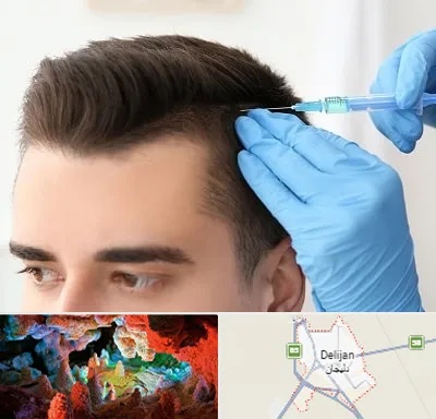 مزوتراپی مو در دلیجان