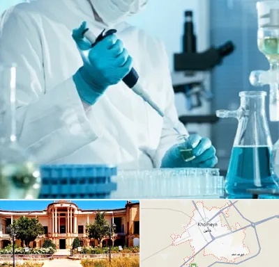 آزمایشگاه HIV در خمین