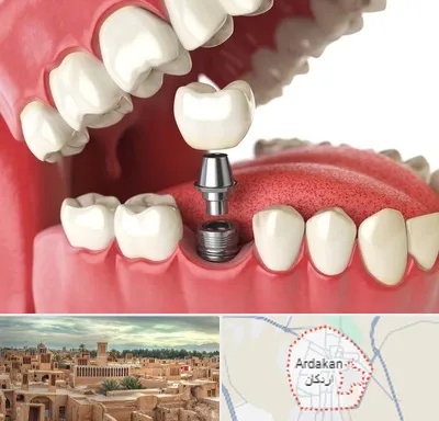 متخصص پروتز دندان در اردکان