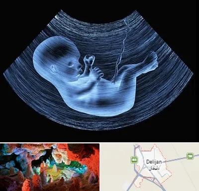 دکتر متخصص غربال گری در دلیجان