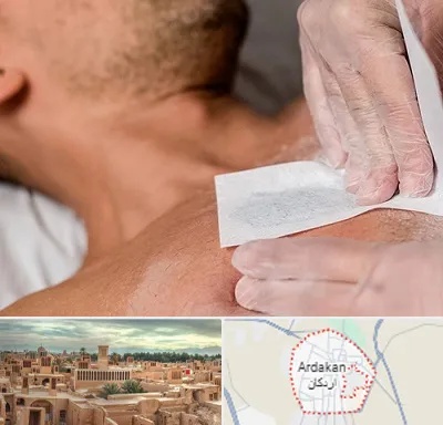 اپیلاسیون آقایان در اردکان