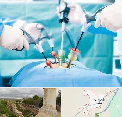 دکتر لاپاراسکوپی در کنگاور