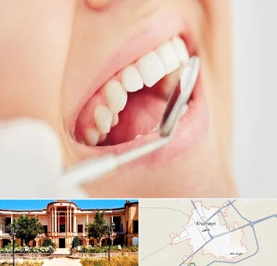 اصلاح طرح لبخند در خمین