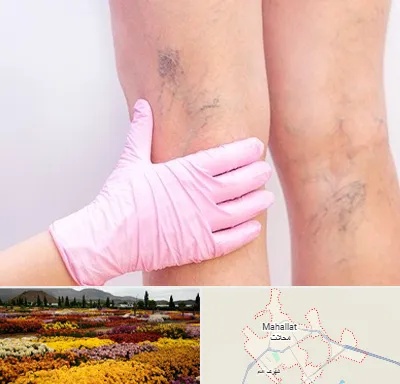 دکتر فوق تخصص واریس در محلات