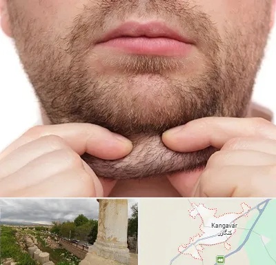 ساکشن غبغب در کنگاور