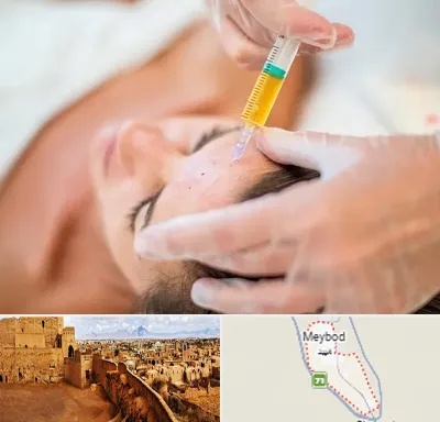 پی آر پی در میبد