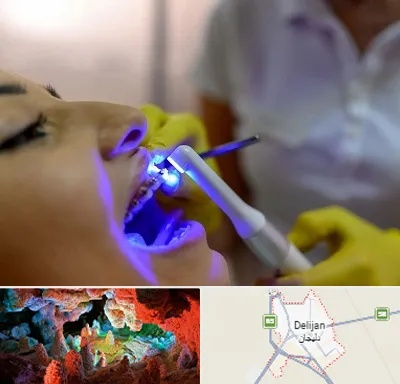 دندانپزشکی با لیزر در دلیجان