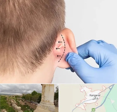 عمل زیبایی گوش در کنگاور