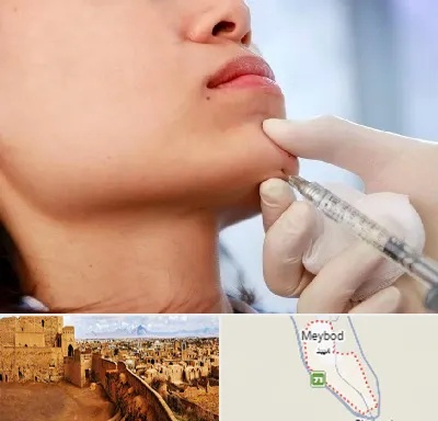 زاویه سازی صورت در میبد
