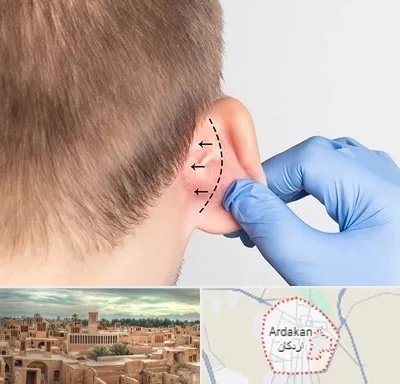 عمل زیبایی گوش در اردکان
