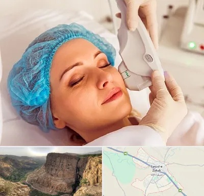 اکسنت در سرپل ذهاب
