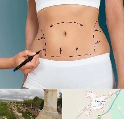 دکتر طب سنتی برای لاغری در کنگاور