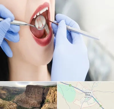 جراح دندان عقل در سرپل ذهاب
