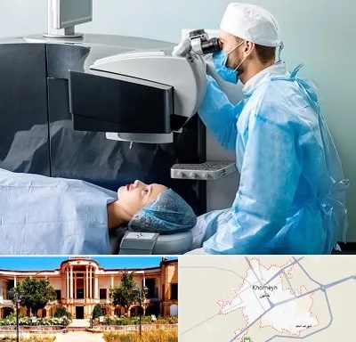 مرکز لیزیک چشم در خمین