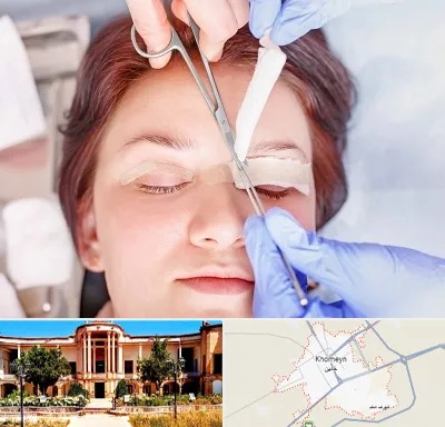 جراحی پلک افتاده در خمین