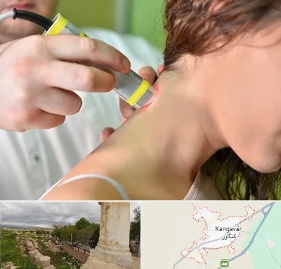لیزر درمانی در کنگاور