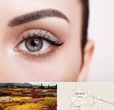 فوق تخصص عنبیه در محلات