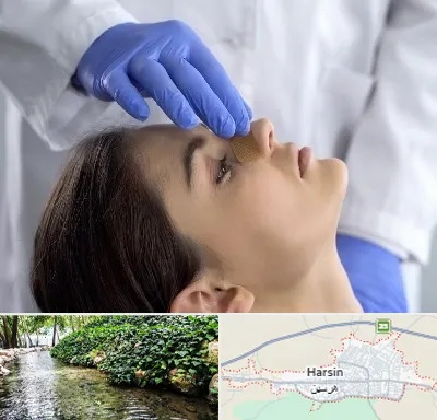 عمل بینی عروسکی در هرسین