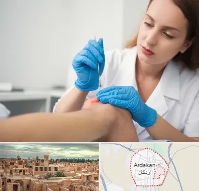 متخصص زخم در اردکان