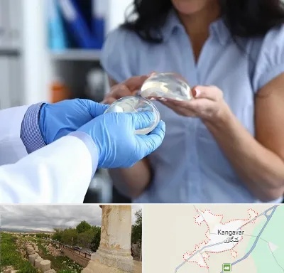 پروتز باسن در کنگاور