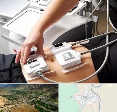 ترواسکالپ در اسدآباد