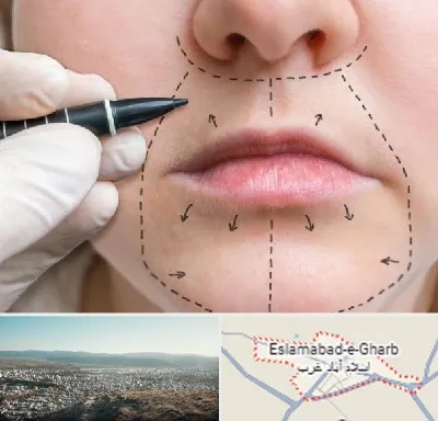 عمل سانترال لب در اسلام آباد غرب