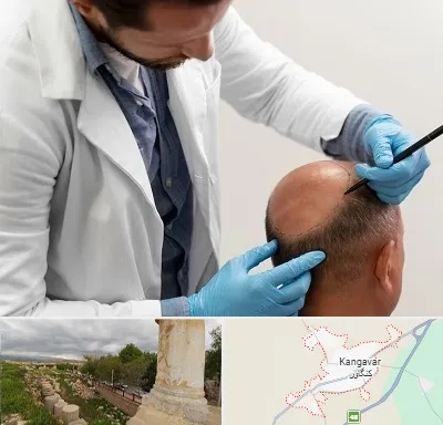 کاشت مو به روش تکثیری در کنگاور