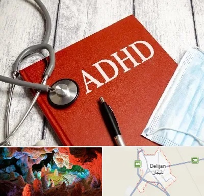دکتر adhd (بیش فعالی بزرگسالان) در دلیجان