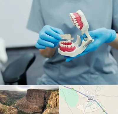 دندانپزشک خانم در سرپل ذهاب