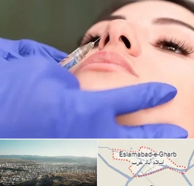 هیالاز در اسلام آباد غرب