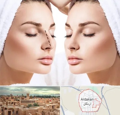 عمل بینی در اردکان
