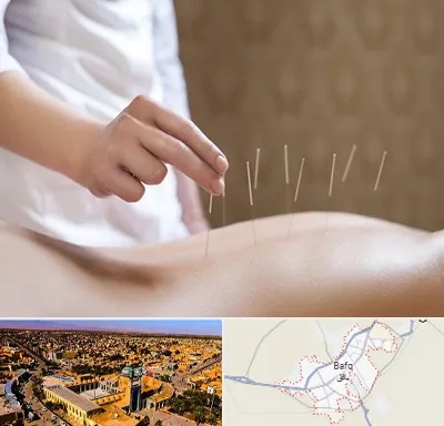 درای نیدلینگ در بافق
