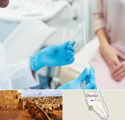 دکتر زگیل تناسلی HPV در میبد
