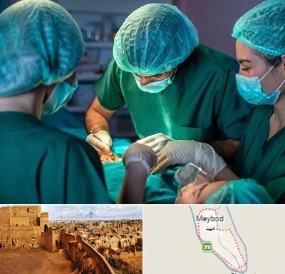 عمل کوچک کردن سینه در میبد
