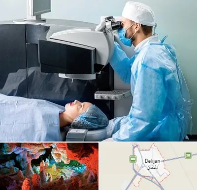 مرکز لیزیک چشم در دلیجان