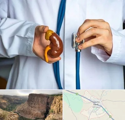 دکتر سرطان کلیه در سرپل ذهاب