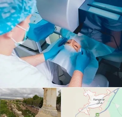 دکتر عمل لازک چشم در کنگاور
