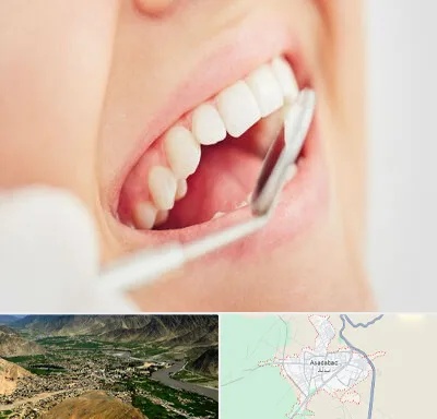 اصلاح طرح لبخند در اسدآباد