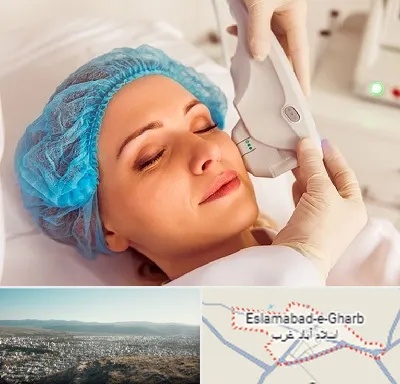 اکسنت در اسلام آباد غرب