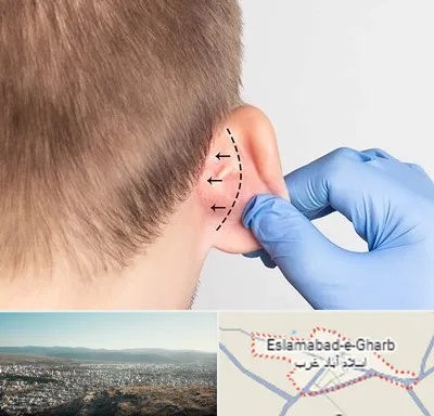 عمل زیبایی گوش در اسلام آباد غرب