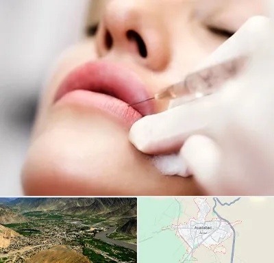 کلینیک تزریق ژل لب در اسدآباد