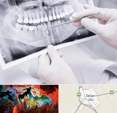 رادیولوژی دهان و دندان در دلیجان