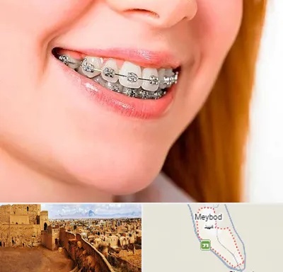 ارتودنسی ارزان در میبد